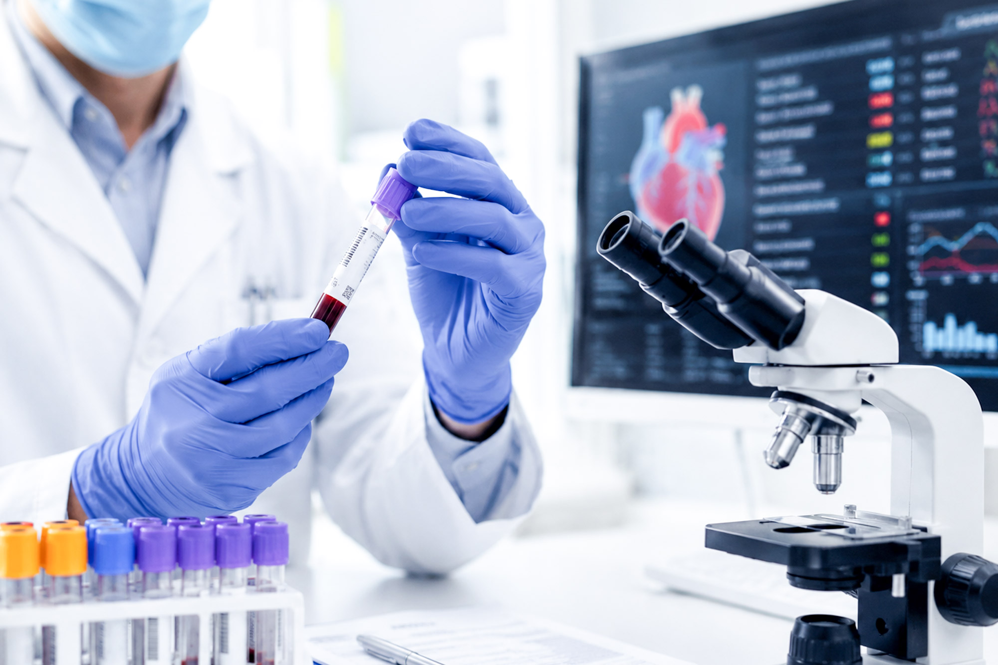 kardiologische-praxis-barth-dr-beug-untersuchungen-Labordiagnostik