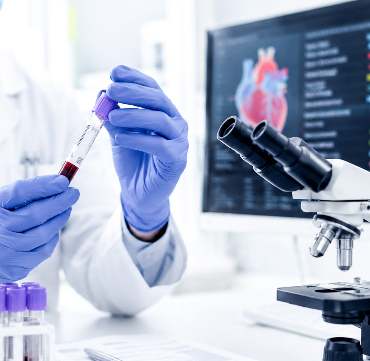 kardiologische-praxis-barth-kardiologische-praxis-barth-dr-beug-untersuchungen-Labordiagnostik kardiologische-praxis-barth-kardiologische-praxis-barth-dr-beug-untersuchungen-Labordiagnostik